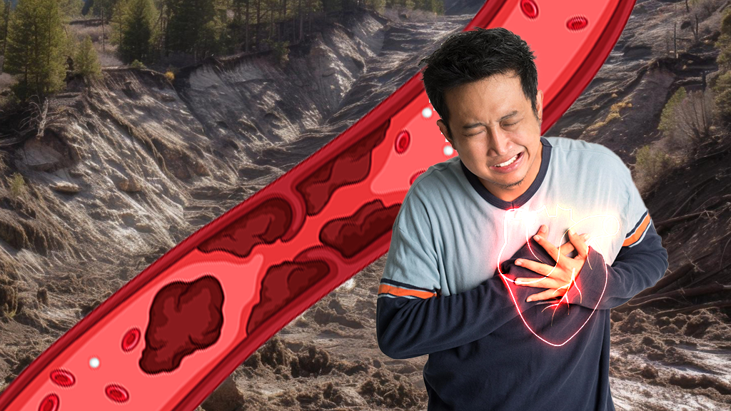 【緊急警報】全台 4 天驚爆 180 例 OHCA!寒流成壯年「奪命符」,你正在血管土石流的邊緣嗎? 【緊急警報】全台 4 天驚爆 180 例 OHCA!寒流成壯年「奪命符」,你正在血管土石流的邊緣嗎?