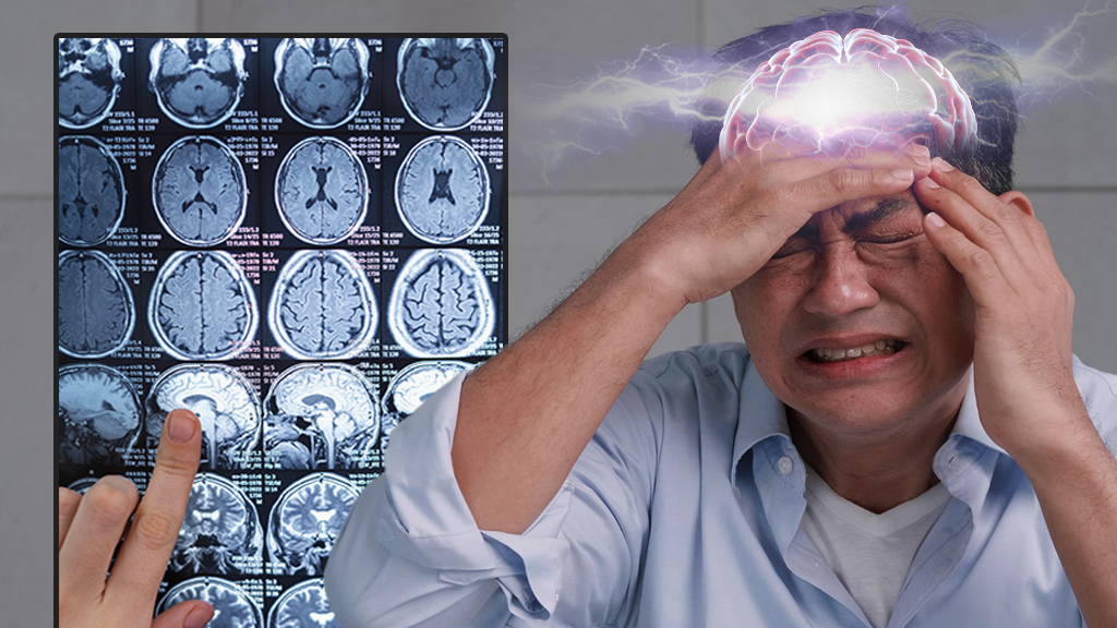 中風不再是老人專利！解析 4 大「隱形警訊」：偏頭痛、眼中風竟是腦部求救訊號？