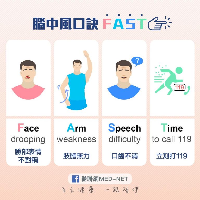 中風不再是老人專利！解析 4 大「隱形警訊」：偏頭痛、眼中風竟是腦部求救訊號？